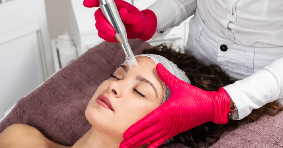 Women Receiving Microneedling In Burke, VA