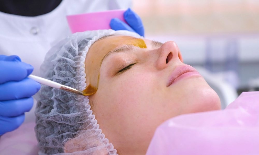 A Female getting chemical peels on her face | Aesthetic Artistry in Botox Burke, VA