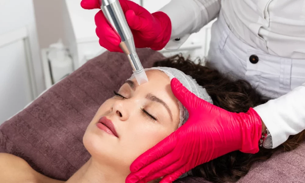 Women Receiving Microneedling In Burke, VA